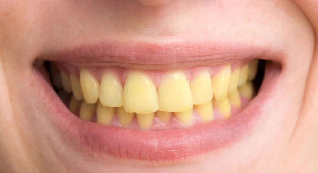 Before treatment result